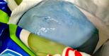 Nuovi casi di mozzarella blu a Frosinone: scattano i sequestri dei prodotti a rischio 