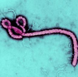 Virus Ebola (Corbis)