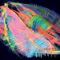 La colpa? È del mio cervello