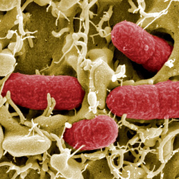 La variante di Escherichia Coli, il batterio killer