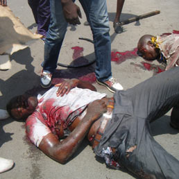Massacro di civili in Costa d'Avorio. Foto e video