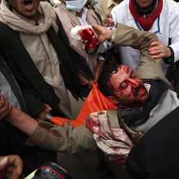 Oltre 30 persone sono morte e più di cento sono rimaste ferite a causa di colpi d'arma da fuoco sparati contro una manifestazione di protesta contro il presidente yemenita Ali Abdallah Saleh a Sanaa (AFP PHOTO/AHMAD GHARABLI)