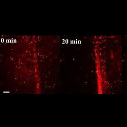 Con le nanoparticelle si curano le fratture